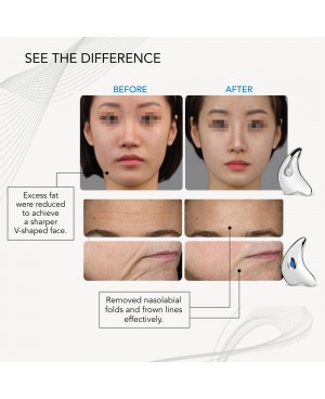 OGAWA Unique Sheen W Facial Lifting and Massage Device With Heat